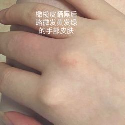 体验前-杭州医巢医疗美容