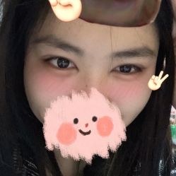 体验后-苏州维多利亚美容医院