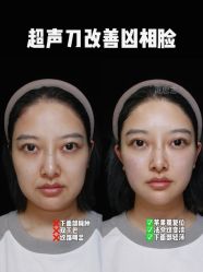 -深圳艺星医疗美容医院