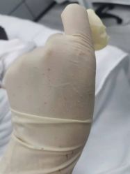 -元熙兰积皮肤管理