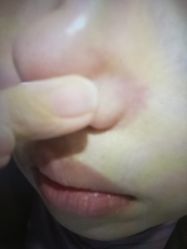 体验后-Hi Beauty Skin 科技美肤中心