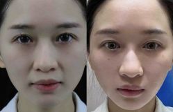 -Yestar 嘉兴艺星医疗美容医院