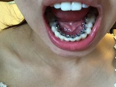 -浙江大学医学院附属口腔医院湖滨（延安）院区