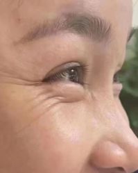 -天津健丽·去眼袋医疗美容机构