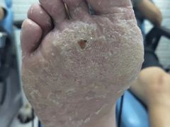 -世龙世家手足健康护理连锁(福田梅林路润裕花园店)