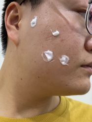 -成都西区医院整形美容