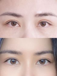 点击看大图 -丰联丽格医疗美容·联合丽格眼整形中心