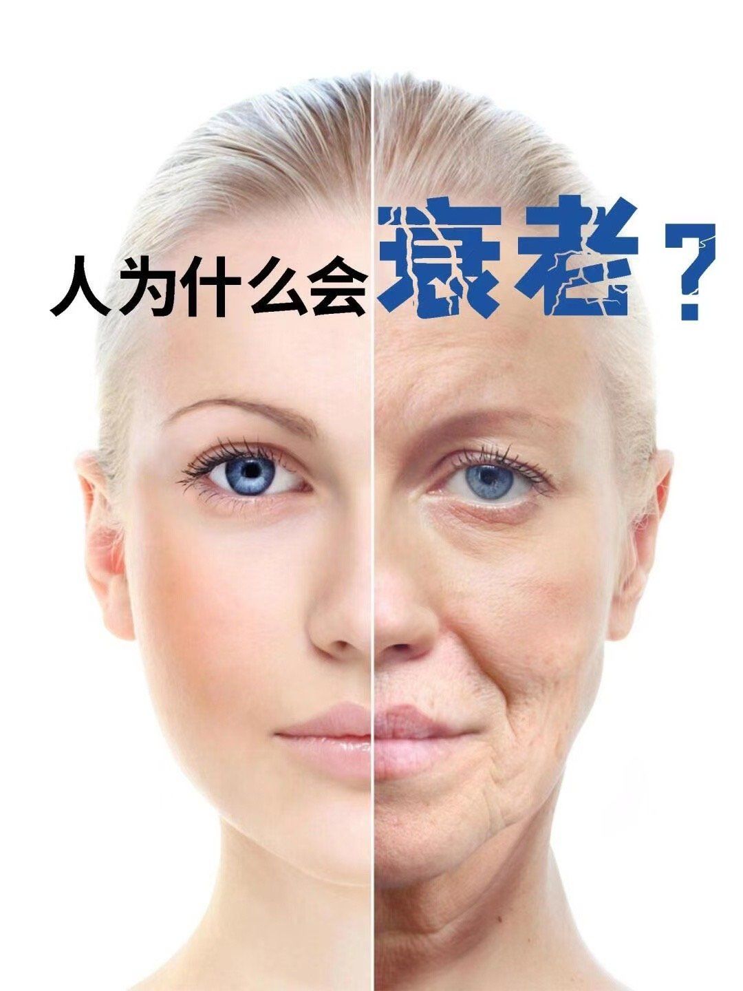 女性脸部衰老的根本原因是什么?