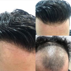 -发饰美男士增发补发假发定制店