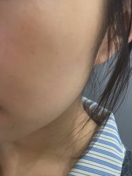 -美瑞莎创美医疗美容