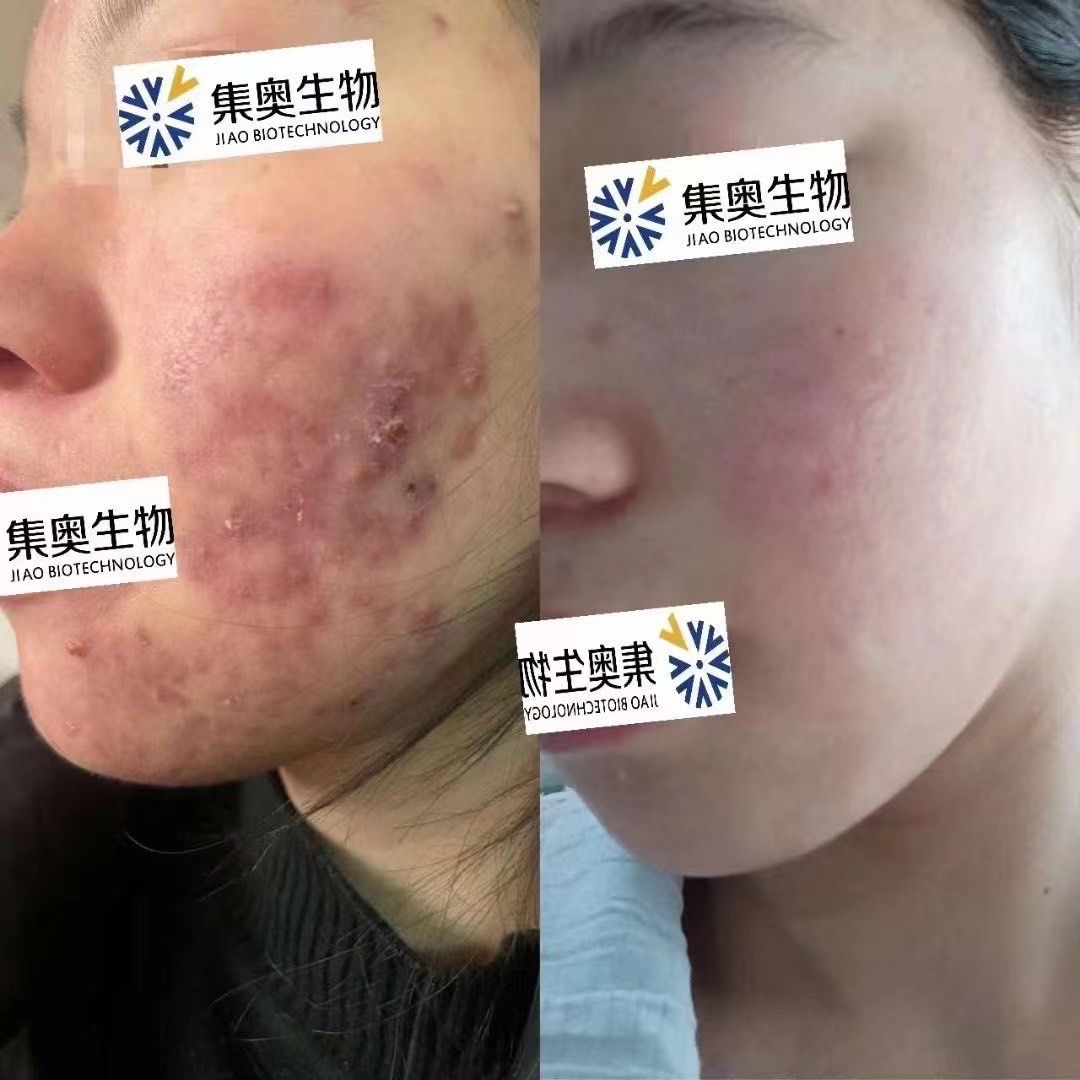 敏兮#肤卉产品技术效果
73 精研问