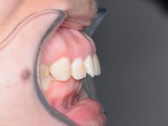 -新达口腔(华东理工大学店)