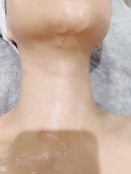 -觅屿日式脱毛美肤