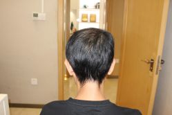 -大麦微针植发丨全国连锁