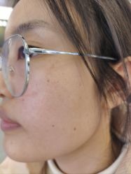 -长沙雅美医疗美容医院