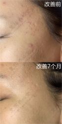 -皇族养心堂·净痘·修敏·御颜