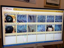 -丝客富脱发养发头皮馆