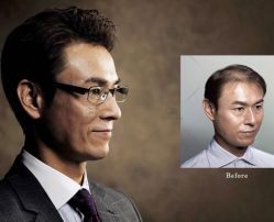 -发饰美男士增发补发假发定制店