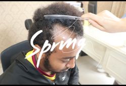 点击看大图 -大麦微针植发全国连锁