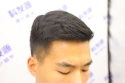 -大麦微针植发丨全国连锁