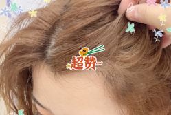 -大麦微针植发全国连锁