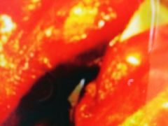 -徐六孃正宗甜皮鸭(张公桥店)