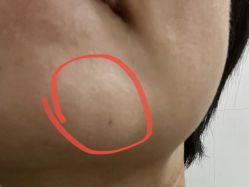 体验后-坤如玛丽·医疗美容中心