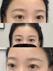 点击看大图 -张小野·专业半永久纹眉