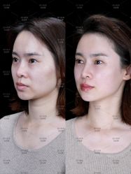 -美莱医学美容医院