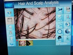 -雍禾植发全国连锁