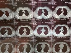 -RD卡丁车汽车俱乐部