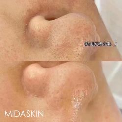 -MIDA蜜哒•科技逆龄美肤连锁