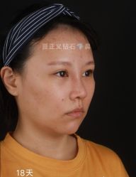 -北京米扬丽格医疗美容·联合丽格鼻整形中心