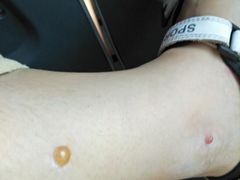 -大连市皮肤病医院