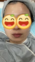 点击看大图 体验后-北京英煌医疗美容