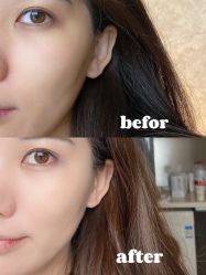 -HYOUNG 禾漾·BTL官方美学中心