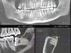 -Dr.Z dental仁康种植矫正中心