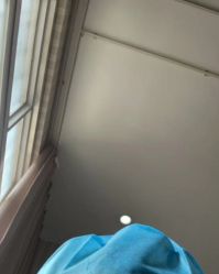 -碧莲盛·不剃发植发