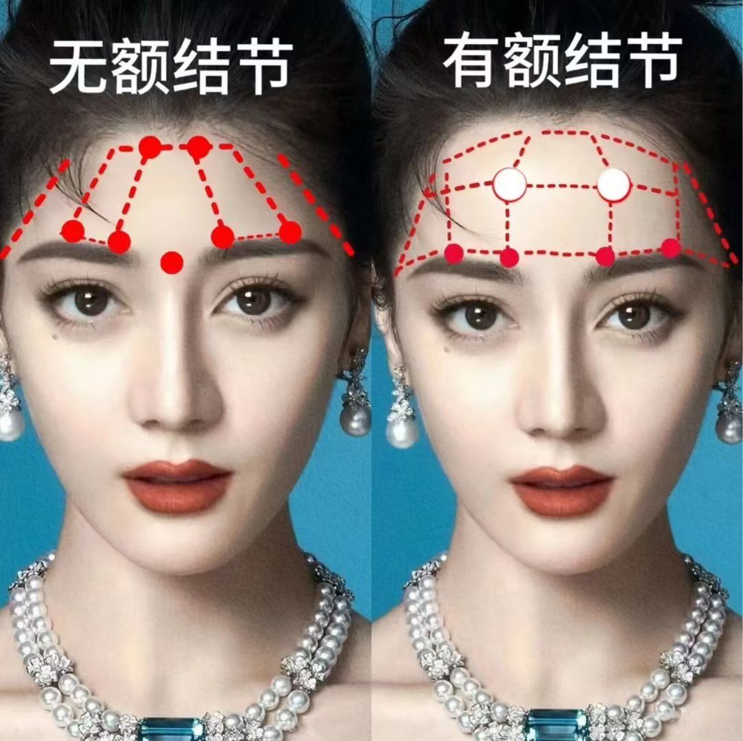 什么是好看的额头❓
✅额结节高光点折