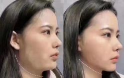 点击看大图 -YESIDO椰岛美容
