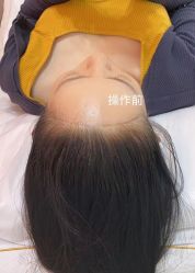 -MISS STAR·半永久纹眉·发际线·美瞳线
