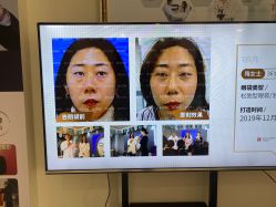-天津健丽·去眼袋医疗美容机构
