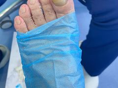 -Andrew指甲专科灰指甲·甲沟炎矫正·3D步态矫形鞋垫定制(浦三路店)