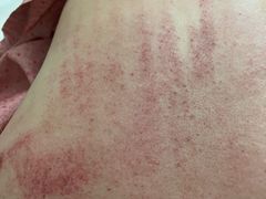 -麻麻手推拿