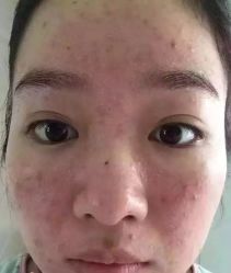 -E.beauty驻颜·痘敏肌调理中心
