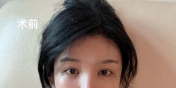 体验前-上海伊莱美医疗美容医院