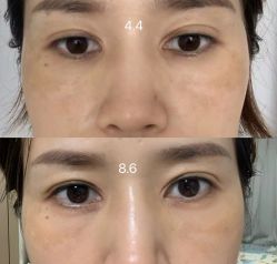 点击看大图 -深圳美莱医疗美容医院