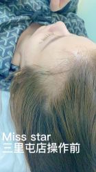 -MISS STAR·半永久纹眉·发际线·美瞳线