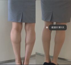 -上海漾颜医疗美容