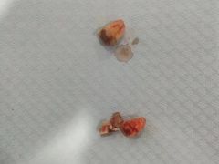 -同步齿科·数字化正畸种植口腔中心(前山店)